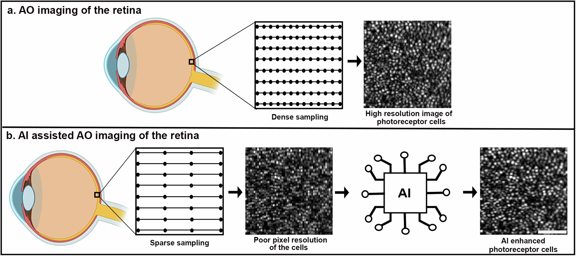 Artificial Intelligence Solutions in Ophthalmology